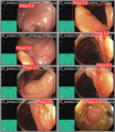 Thumbnail for version as of 16:35, 9 April 2025